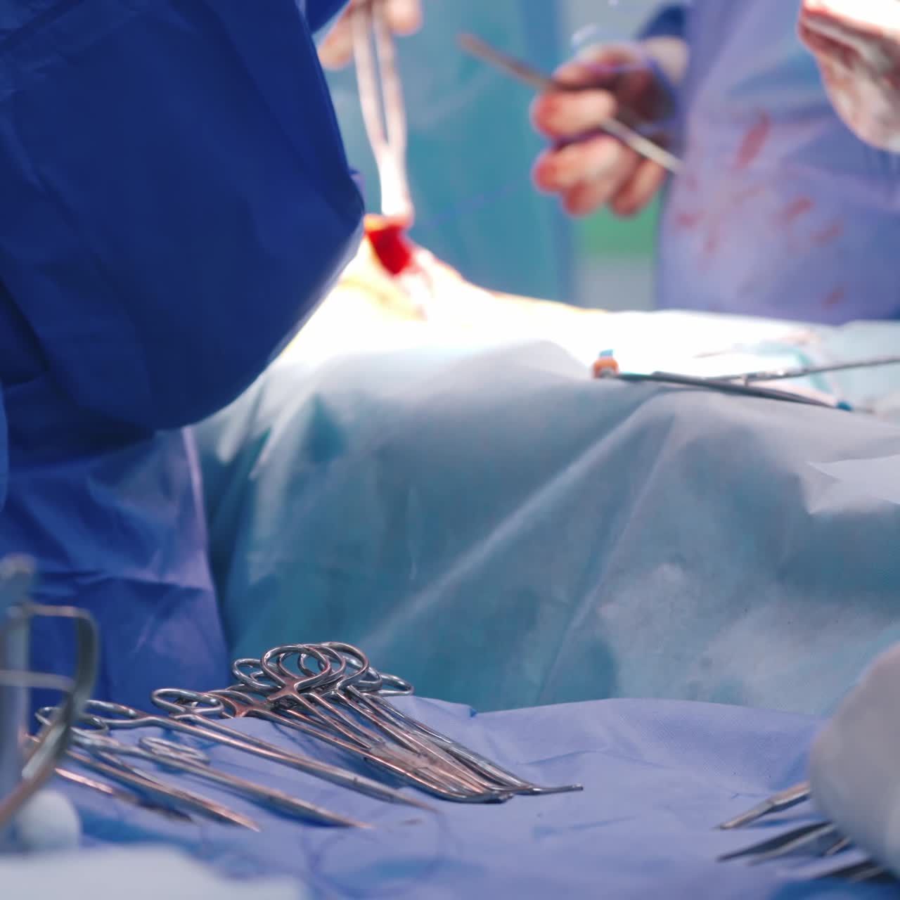 Operating process in clinic. Doctor's hands with blood during operation. Team of surgeons perform a surgery to a patient using medical tools.