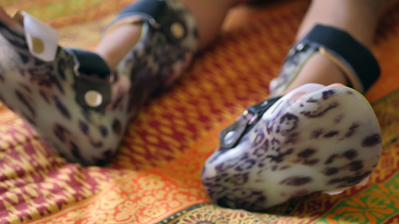 niño que lleva aparatos ortopédicos en el tobillo