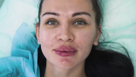 mujer con labios inflamados después de un procedimiento de aumento
