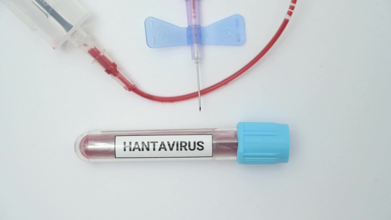 Medical professional taking a blood sample for hantavirus testing on a white background