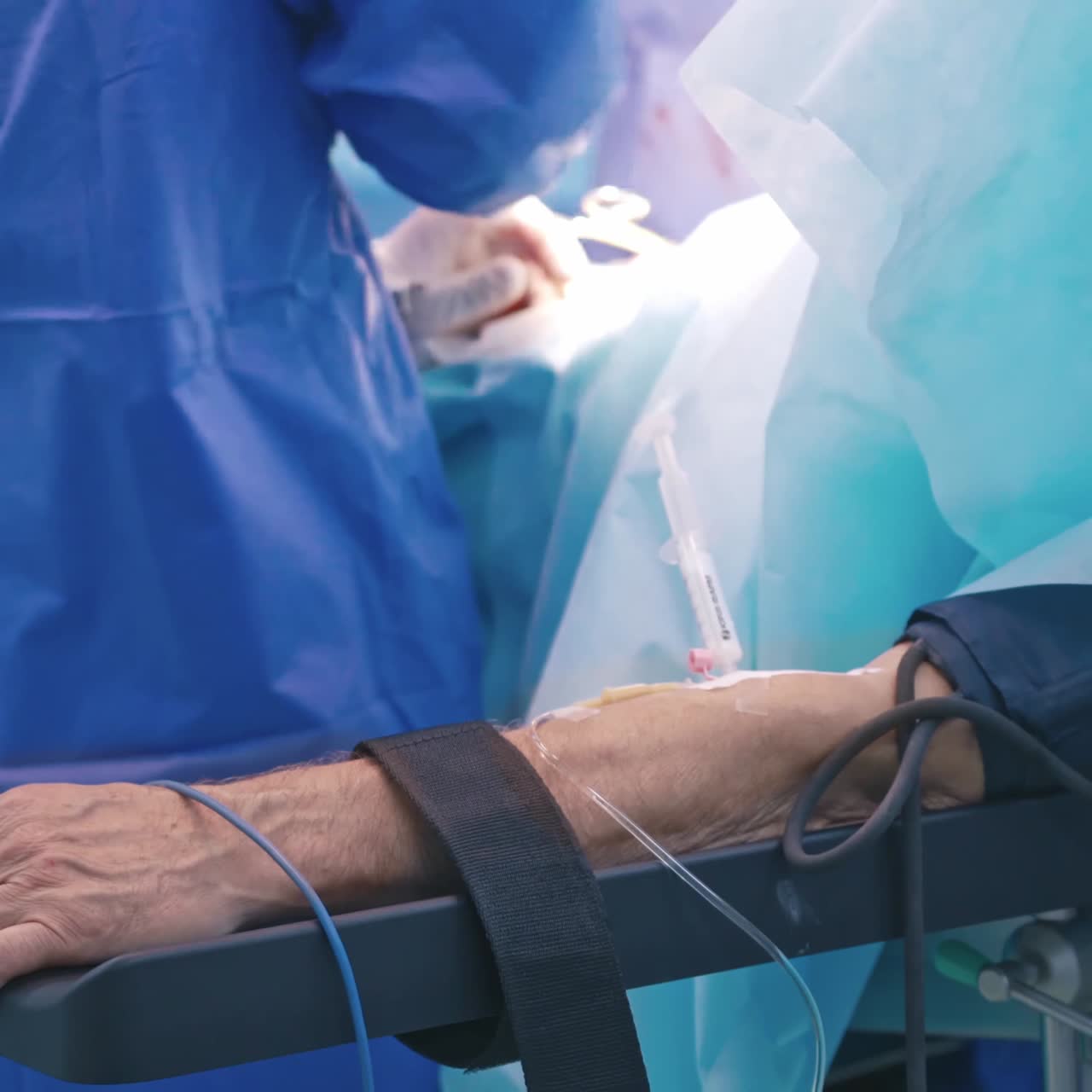 Process of surgery operation