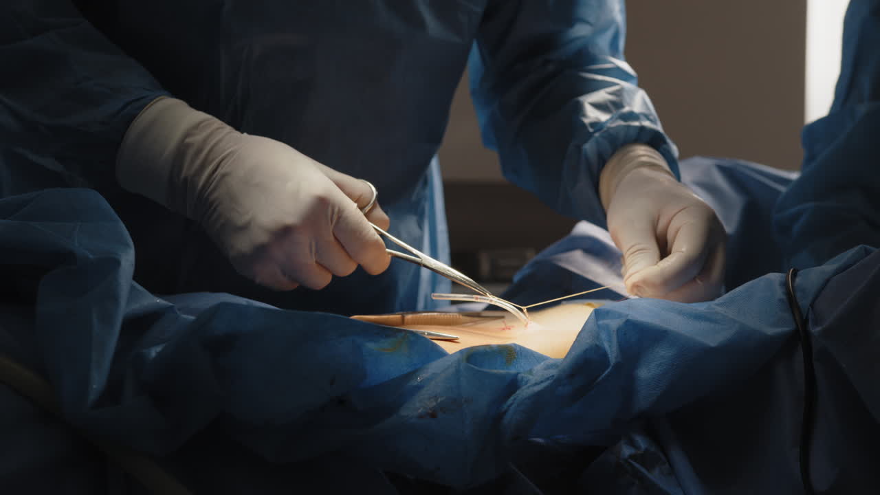 procedimiento quirúrgico