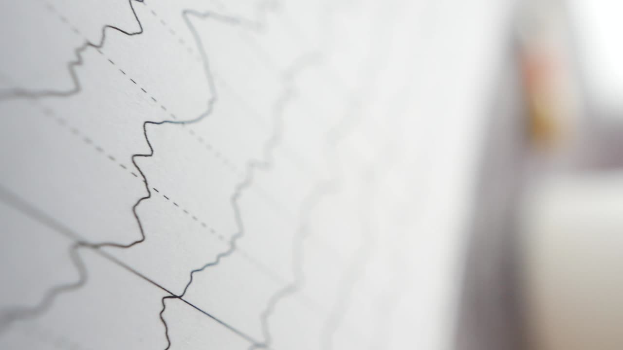 Close-up of a chart or graph