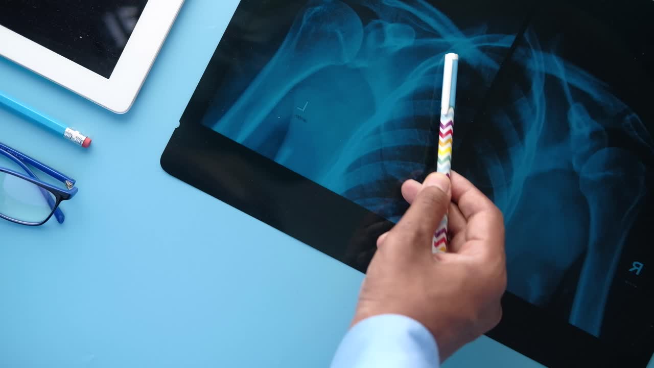 médico que examina las radiografías del hombro