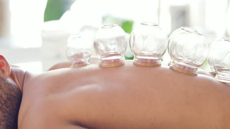 Man-at-a-spa-getting-a-cupping-massage-on-his-back