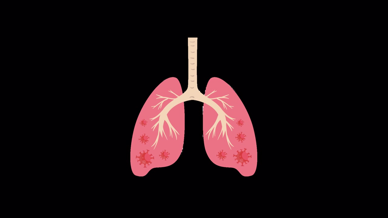 Illustrazione animata di infezione virale nei polmoni umani