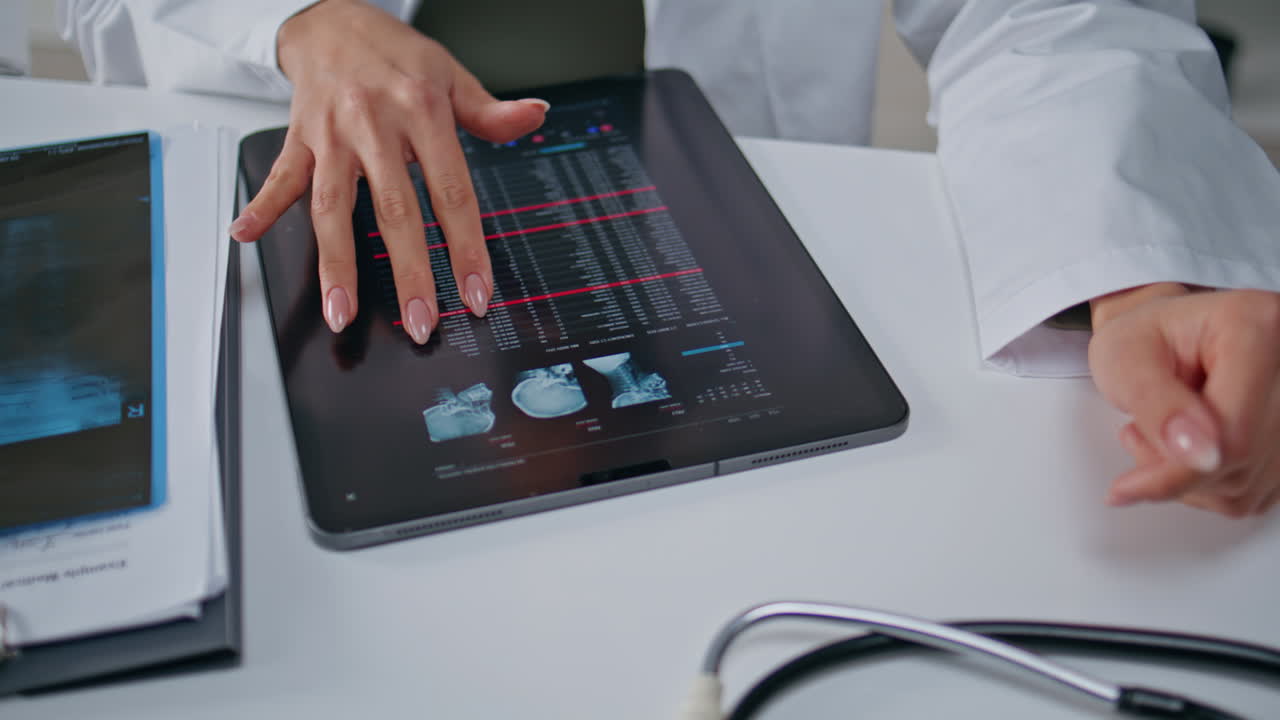 Medic hands analyzing x-ray images of arm on tablet at clinic office closeup