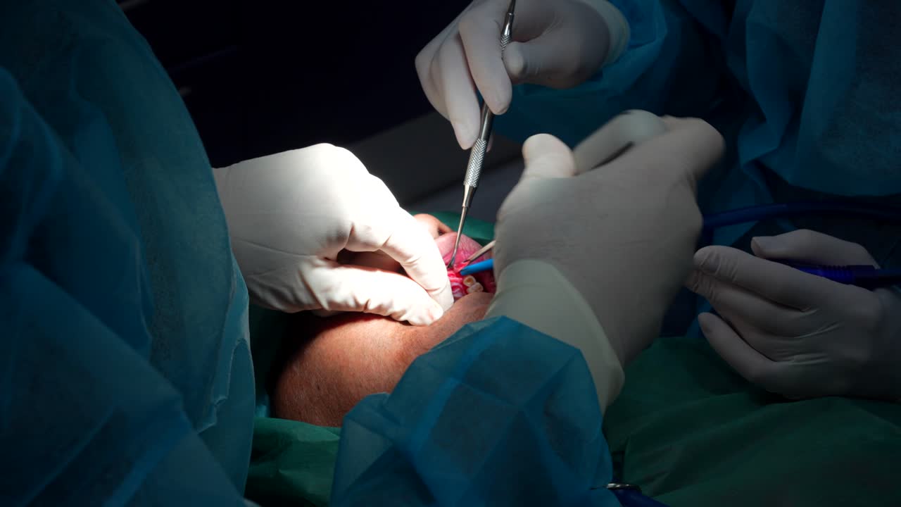 стоматолог использует отвертку, чтобы сделать отверстие в желуди для извлечения зубов, 4к