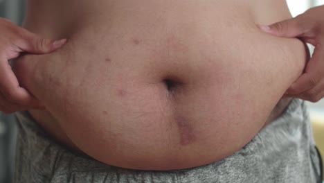 close-up of a person's large belly