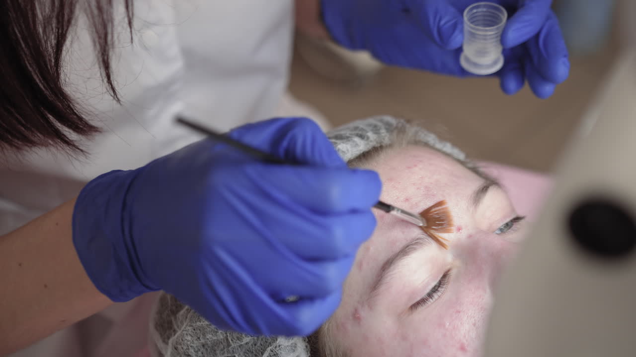 sesión de tratamiento facial