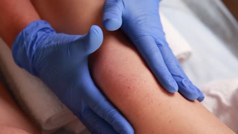 medical treatment of a leg