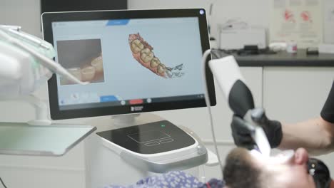 doctor scans the patient's teeth in the clinic. the dentist holds in his hand a manual 3d scanner for the jaw and mouth. dental health. creates a 3d model of teeth and gums on a medical monitor.