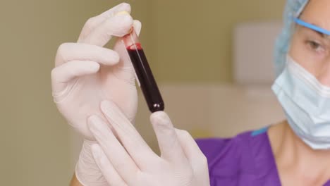 platelet-rich plasma preparation. tube with blood in hands.