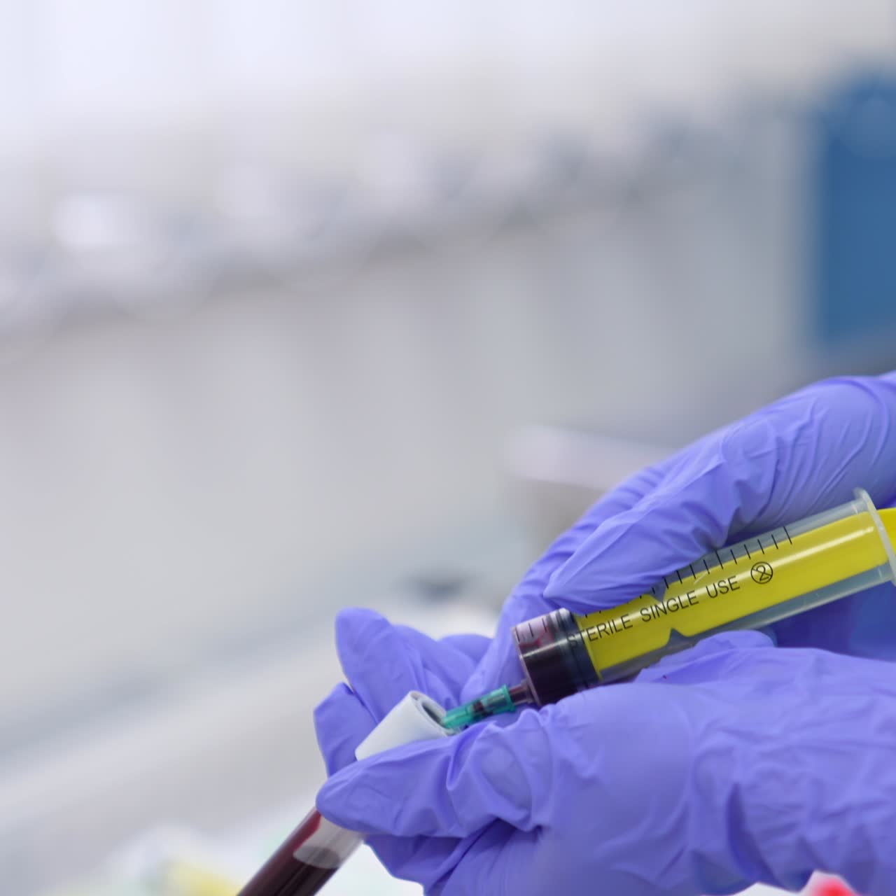 Filling the test tube with vein blood from syringe. Gloved hands preparing sample of blood for analysis. Close up