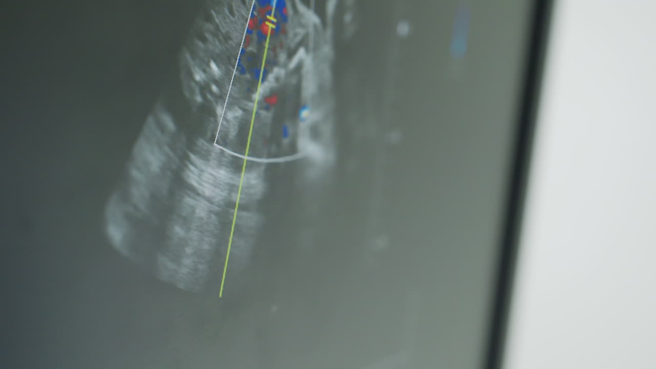 Close up of radiography machine screen displaying angular shape wave movement in high resolution during internal imaging analysis with highlighted color-coded areas indicating motion detail