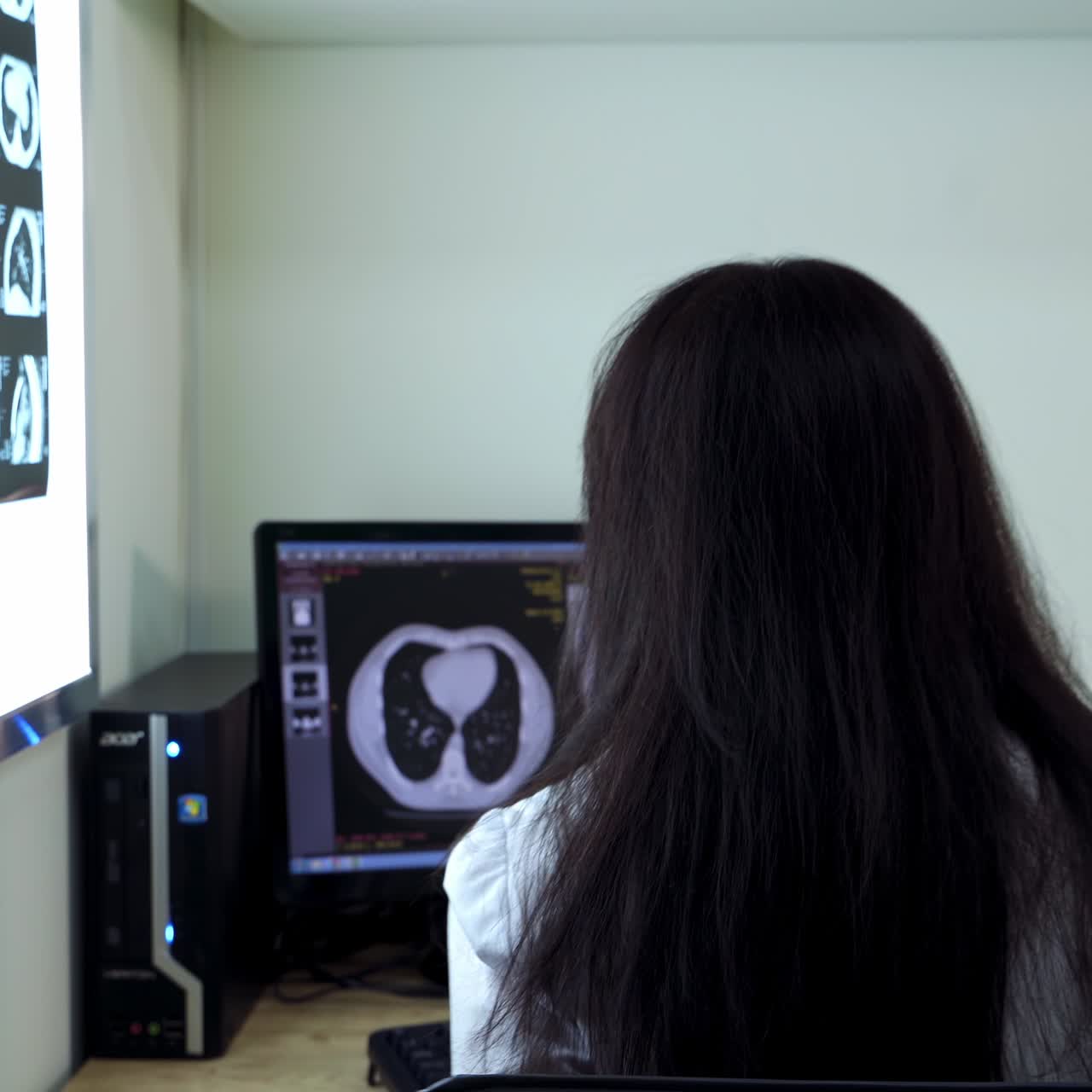 Medical specialist looking attentively at the MRI scans on the light board. Lab worker sits at the computer to take notes