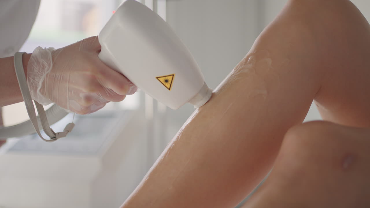 현대 미용실에서 화장품 및 탈모 미용사는 레이저 또는 ipl 장치를 사용합니다.