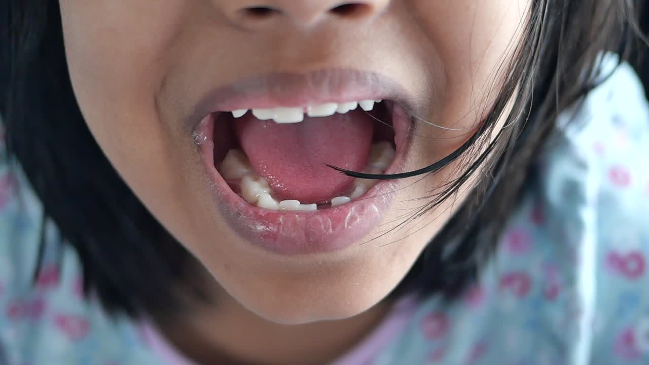 boca abierta del niño