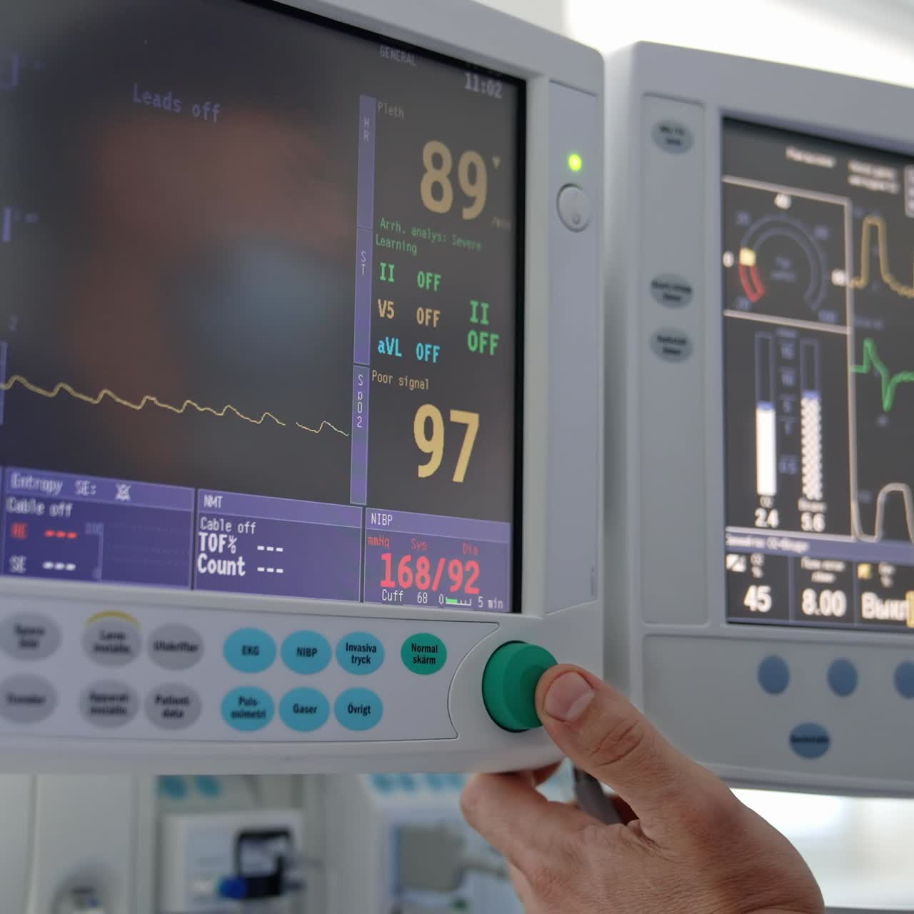 Medical monitors in the operating room. Doctor changes data on the monitor screen in intensive care unit. Screen shows vital signs of a patient