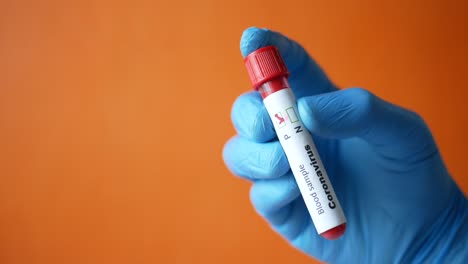 prueba de muestra de sangre de coronavirus