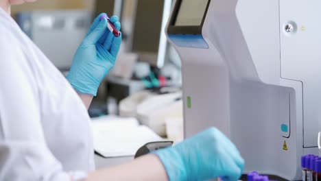 laboratory worker with blood samples. woman's hands in sterile gloves working with test tubes on the table in the laboratory. medical concept.