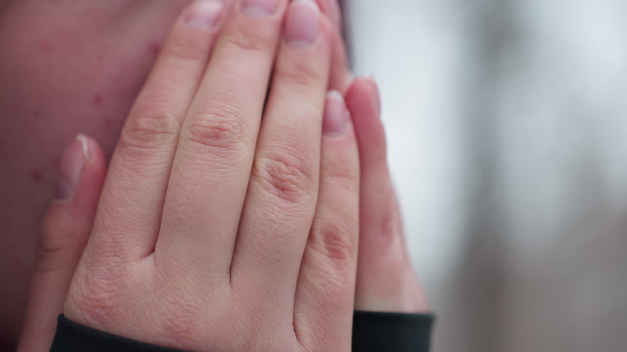 vista de cerca del rostro de una mujer joven que siente frío en invierno, frotándose las manos para calentarse, nariz roja y piel seca resaltan las duras condiciones climáticas, el fondo borroso de árboles desnudos mejora