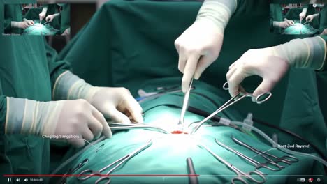 detailed surgical procedure with medical instruments at work: close-up of the team's hands and tools used in a surgical operation