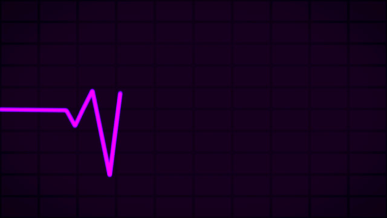 electrocardiogram (EKG or ECG) loop purple