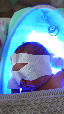 baby under phototherapy light