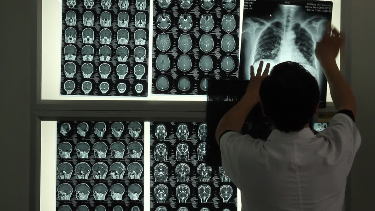 Doctor with brain and long x-rays