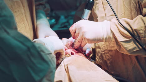 surgery team operating