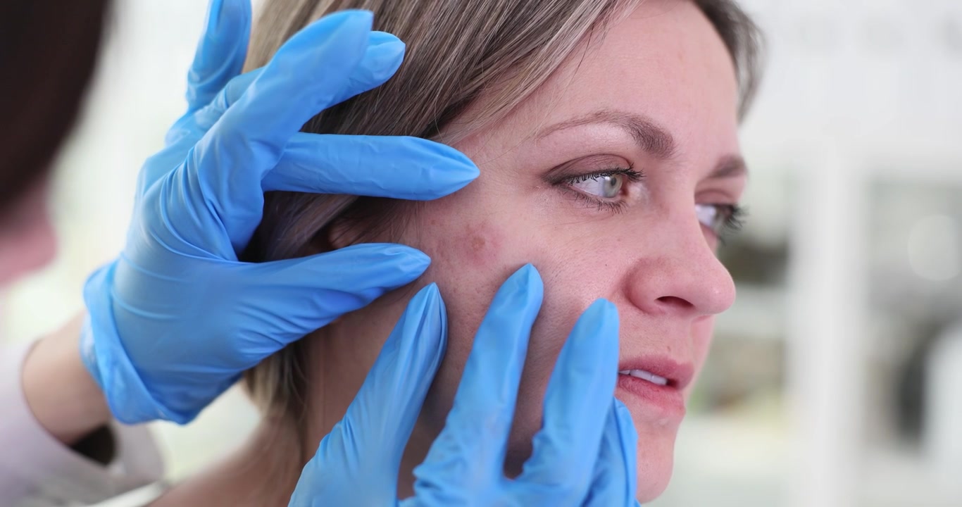 Dermatologo esamina un piccolo brufolo sul viso di una donna