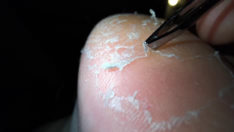 close up video of foot skin exfoliation 2