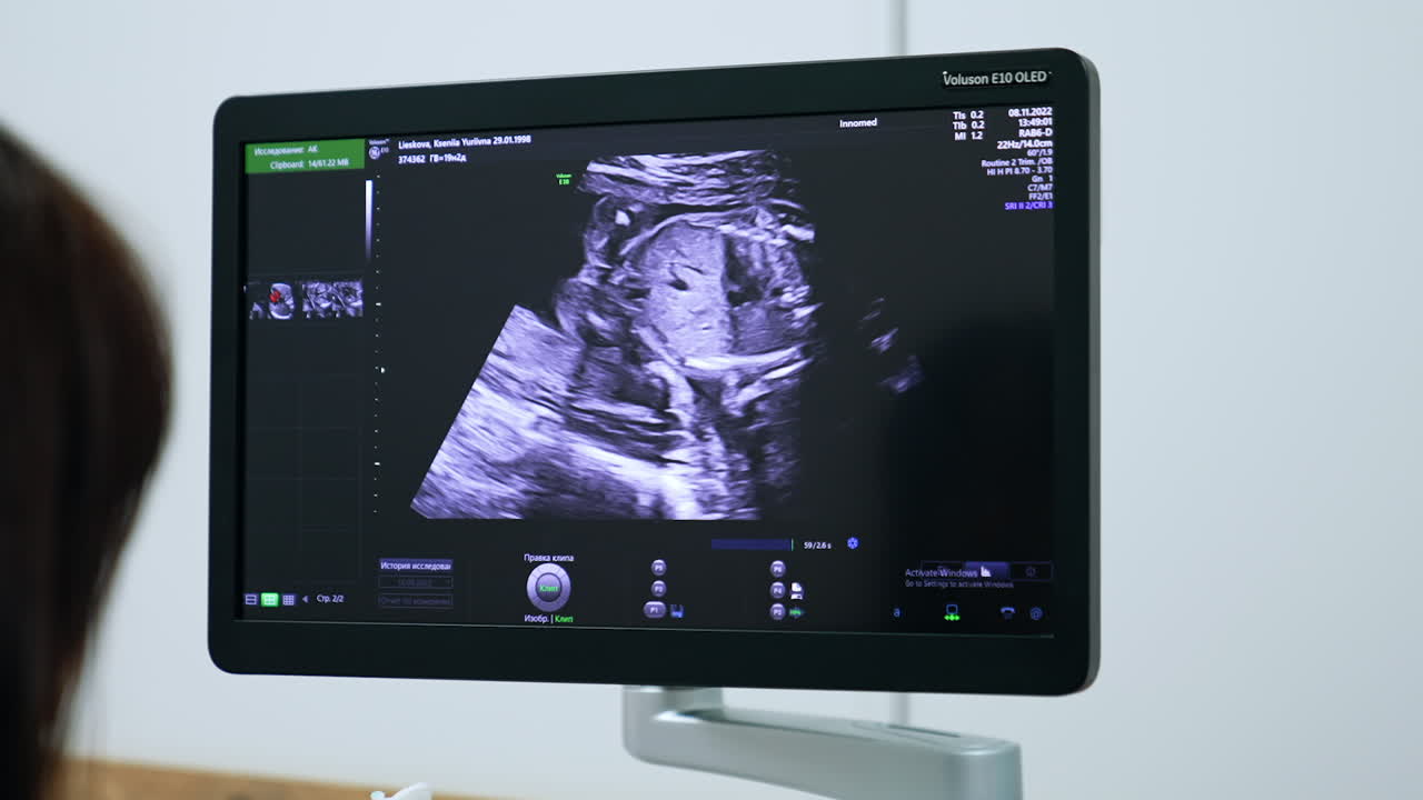 Doctor looks at the screen of ultrasound machine. Obstetrician check the pregnancy development on modern equipment.
