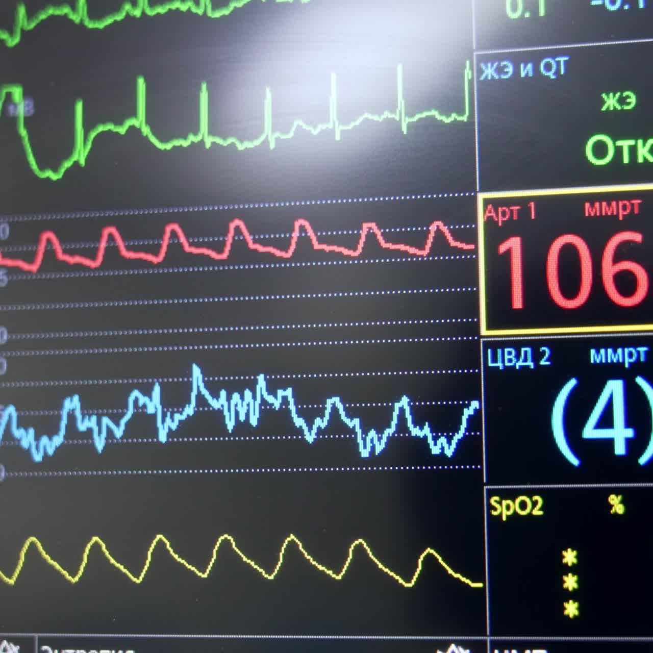 Diverse color curve lines of heart rate, oxygen levels and parameters on the black monitor. Lung ventilator machine screen
