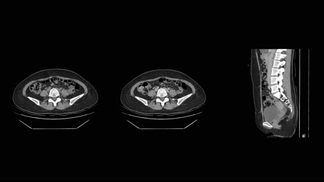 ct scan analysis for appendicitis and gallstones in patients radiology room medical imaging clinical viewpoint