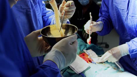 Surgeons-performing-operation-4k