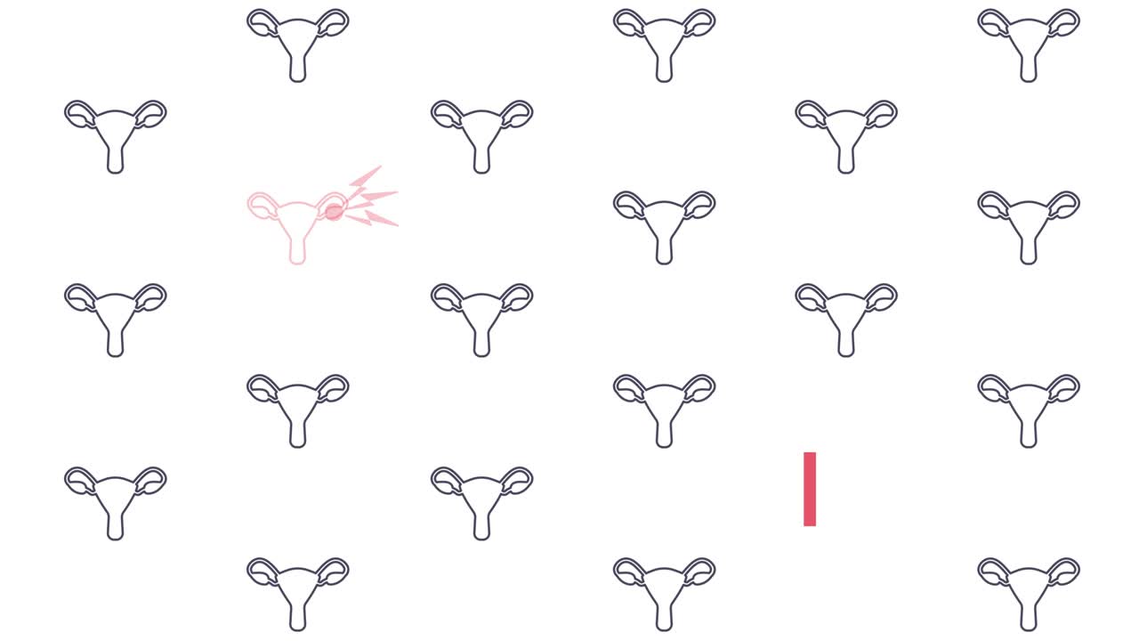 난소암 인식을 위한 자궁 패턴 애니메이션