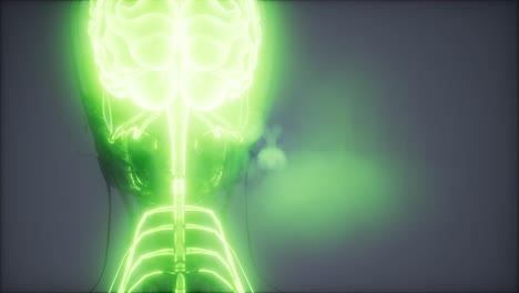 examen de radiología del cerebro humano