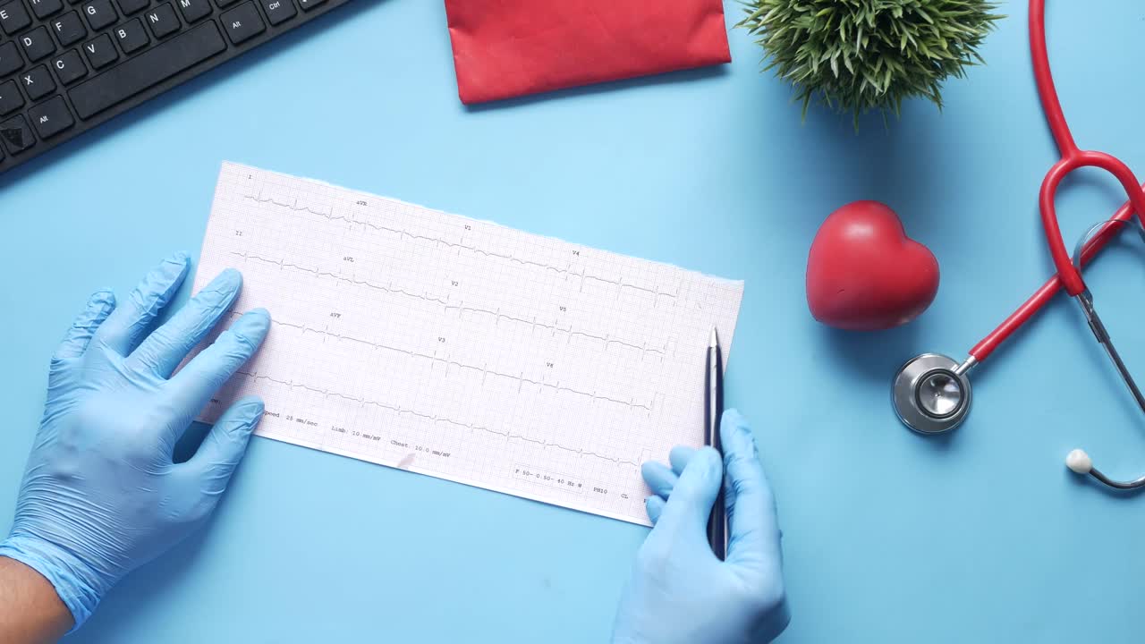 врач, рассматривающий экг