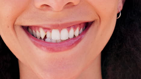 Woman,-mouth-and-teeth-whitening-with-veneers