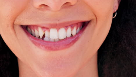 mujer, blanqueo de la boca y los dientes con revestimientos