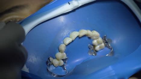 Relaxed patient preparing for dental treatment and teeth cleaning by a professional hygienist