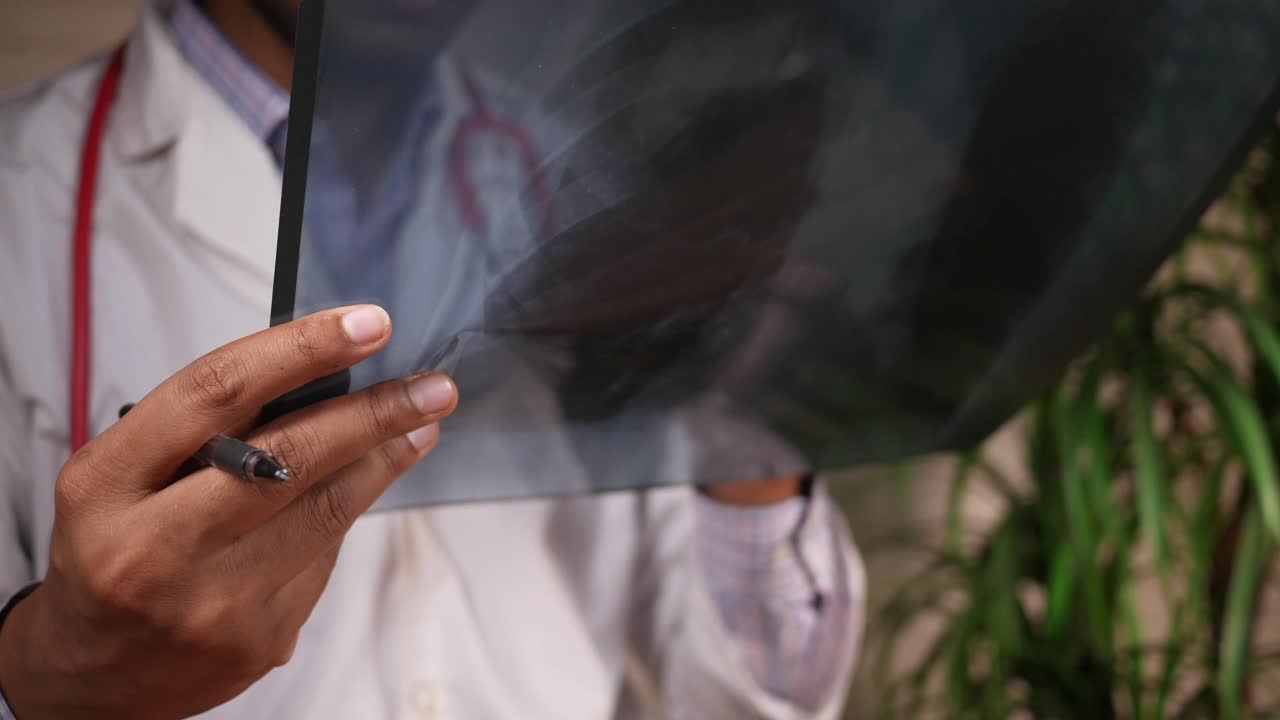 Doctor reviewing chest x-ray