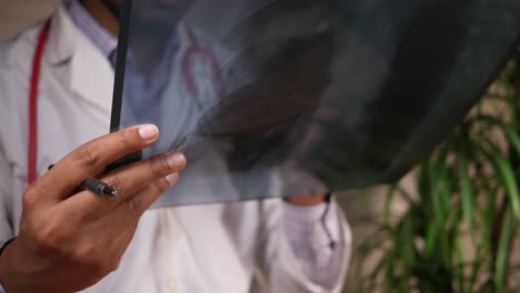 doctor reviewing chest x-ray