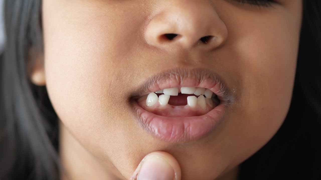 Child with a missing tooth