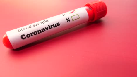 coronavirus blood sample test tube