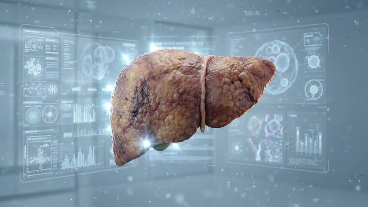 3D Medical Animation of a Diseased Human Liver