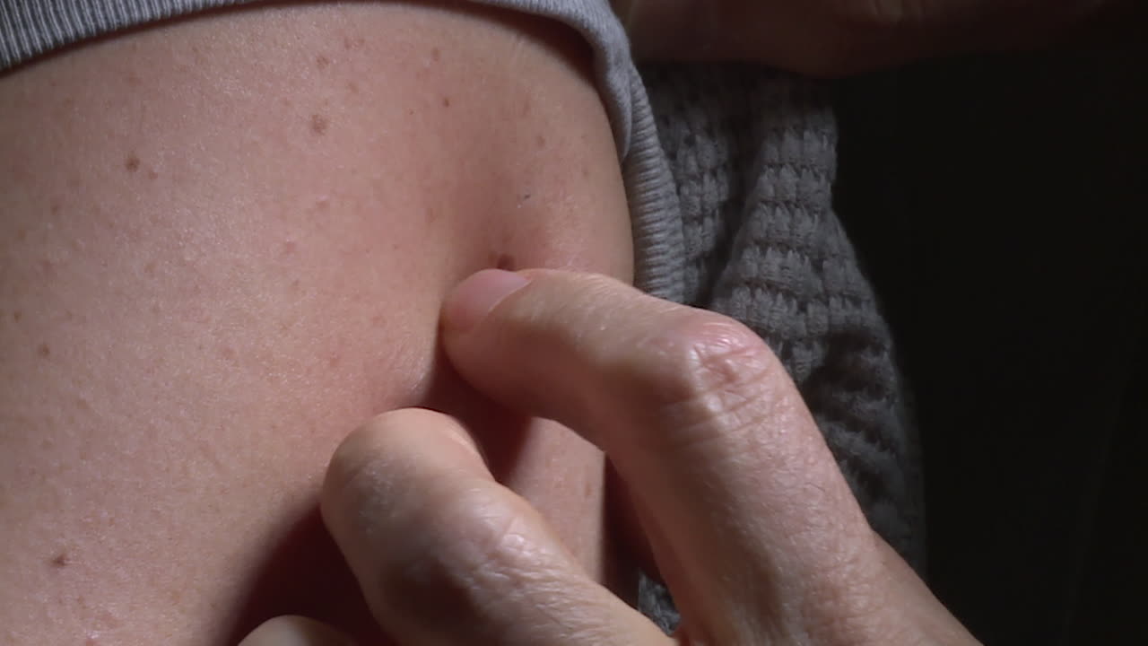 Checking for a lump on the arm