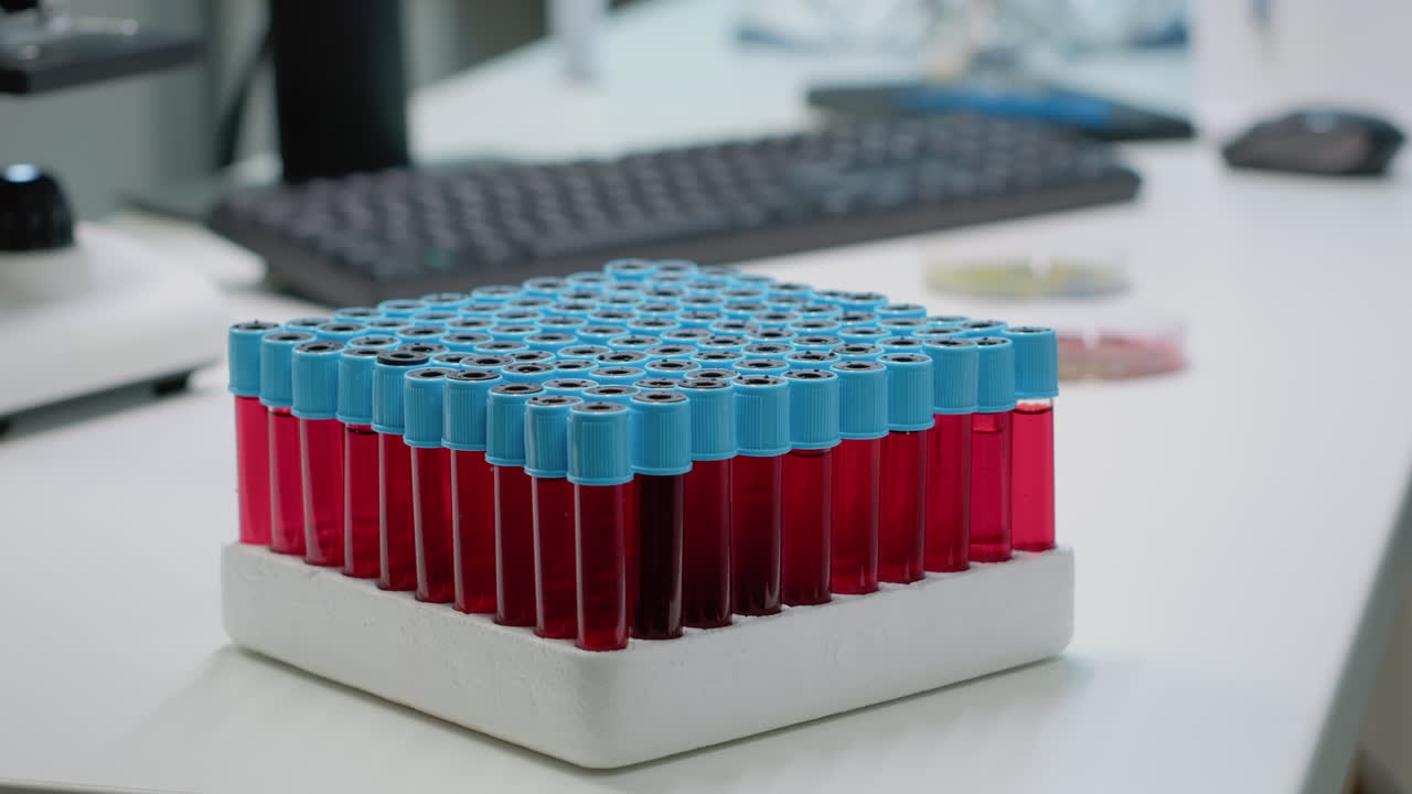 Blood Samples in a Laboratory
